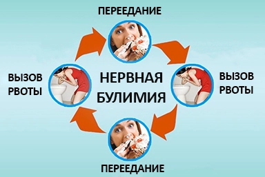 Лечение булимии в Шлиссельбурге
